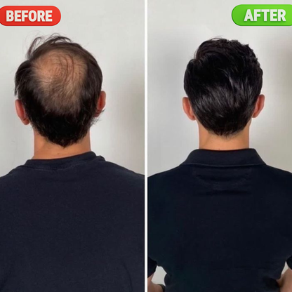 TYNARA™ SHAMPOO