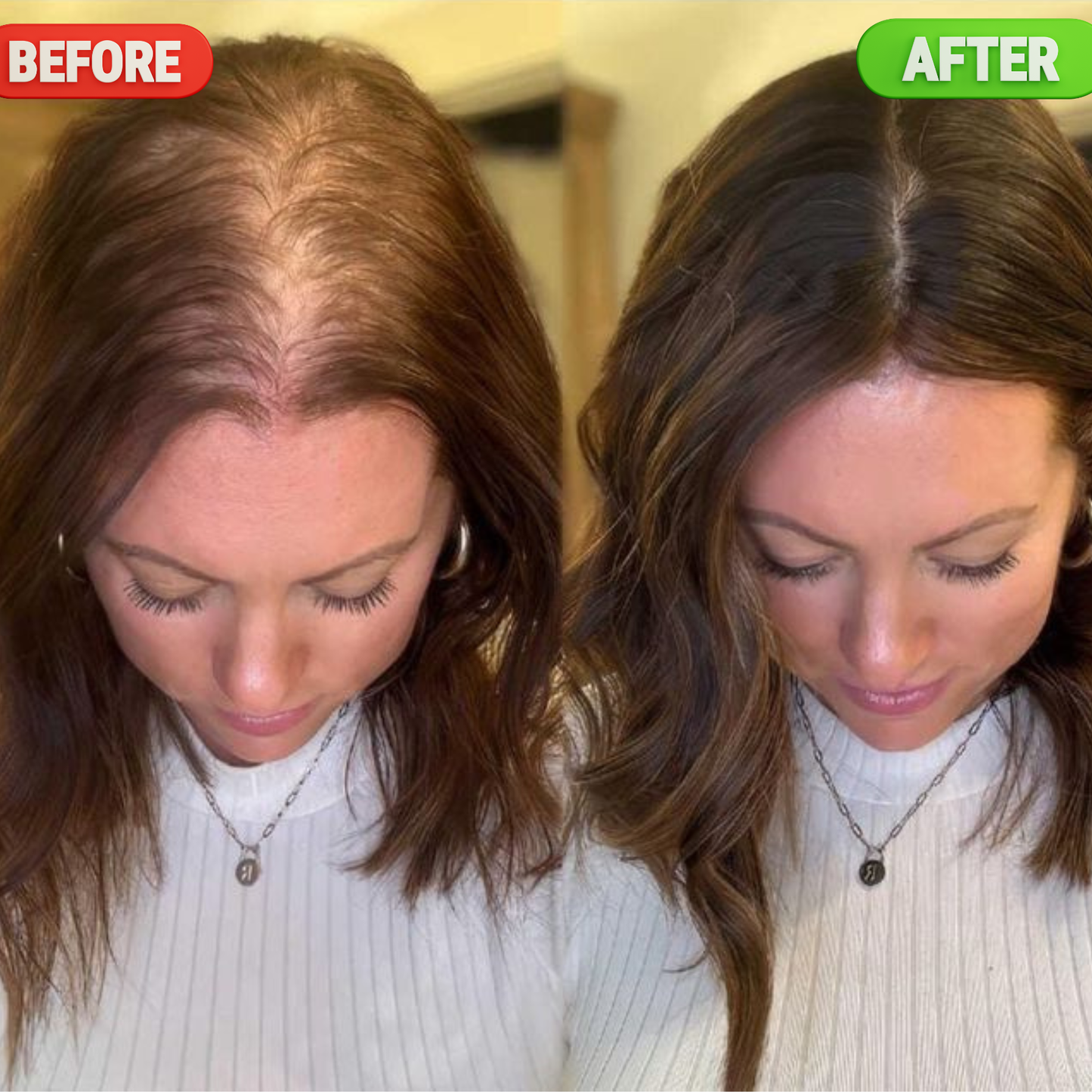 TYNARA™ SHAMPOO